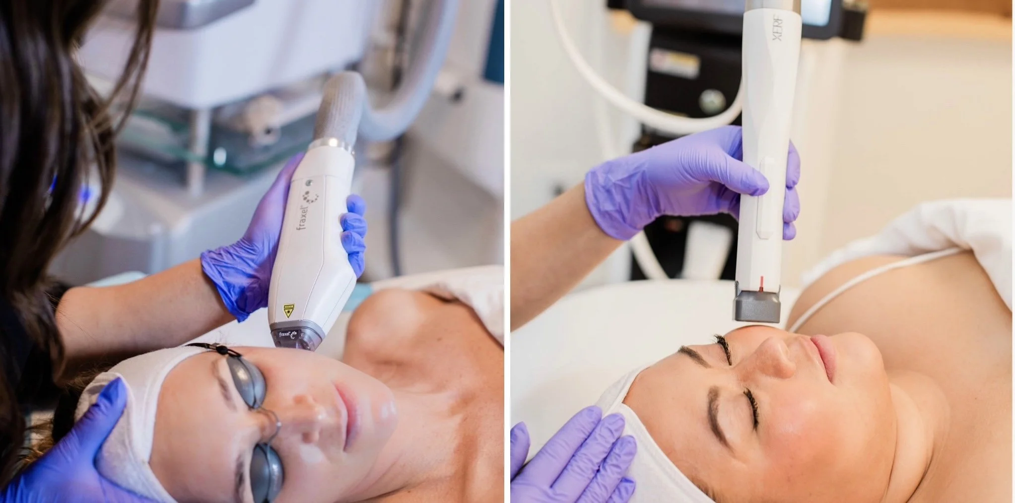 Tight and Bright: The Ultimate XERF + Fraxel Skin Rejuvenation Series in Aspen