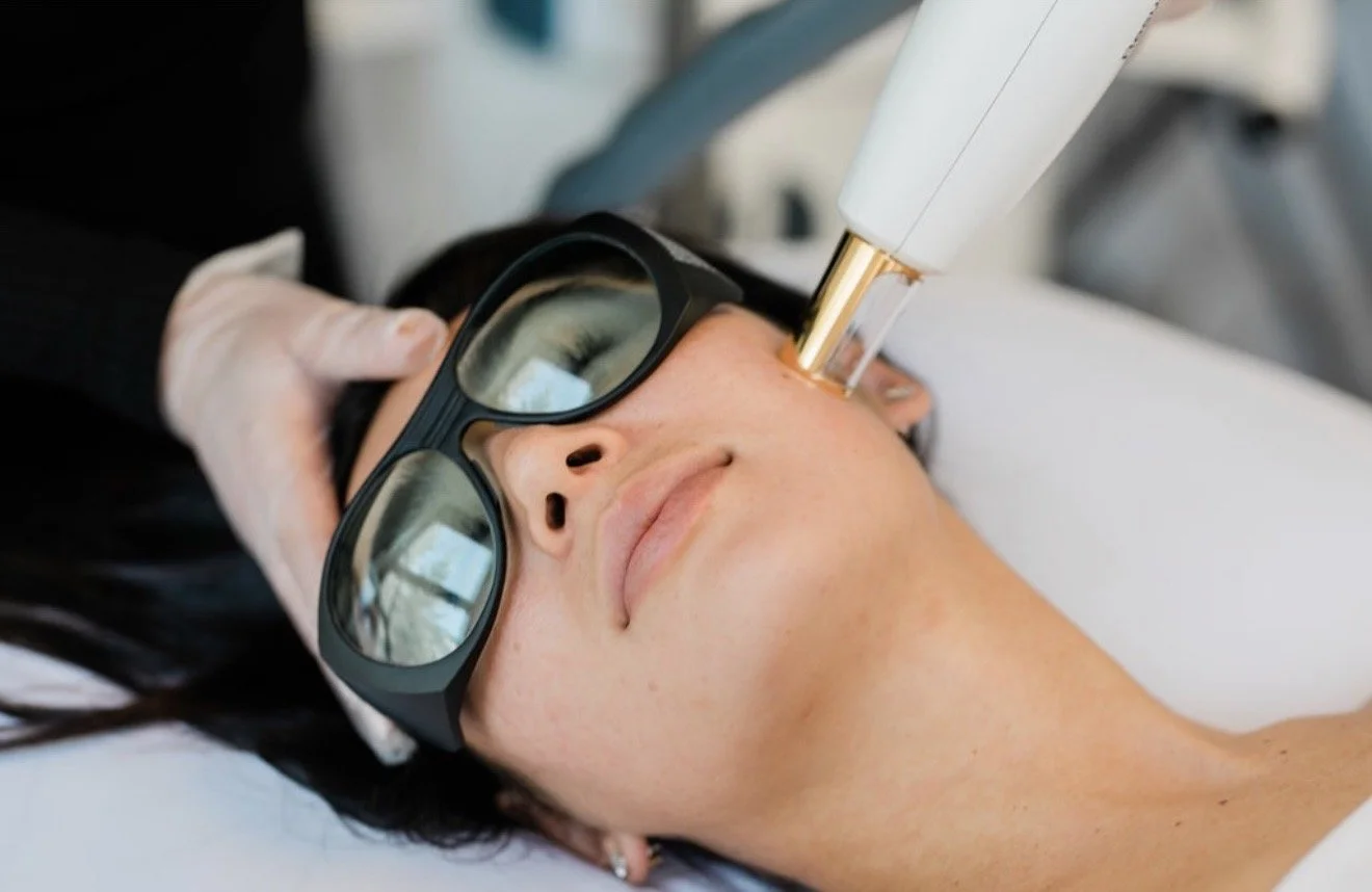 IPL in Aspen: What It Can Do for Sun Spots and Redness
