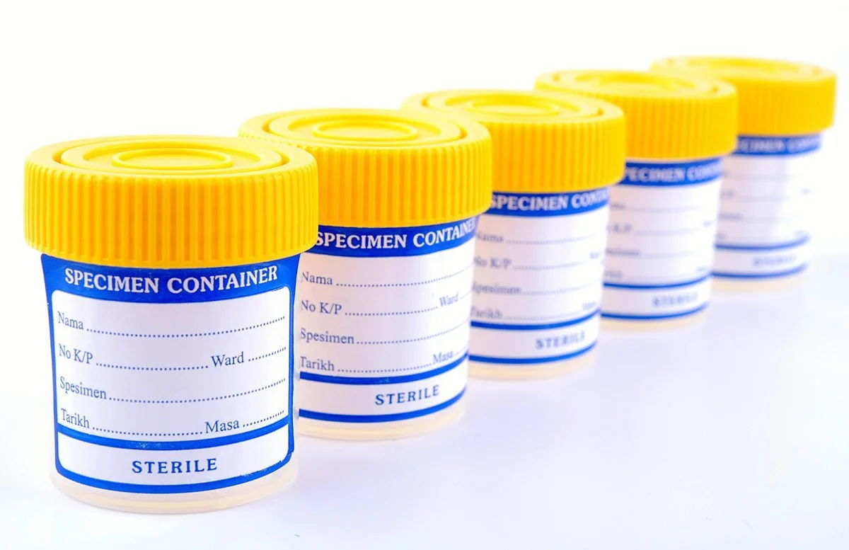 Federal Transportation Department Wants to Reform Drug Testing Through Saliva