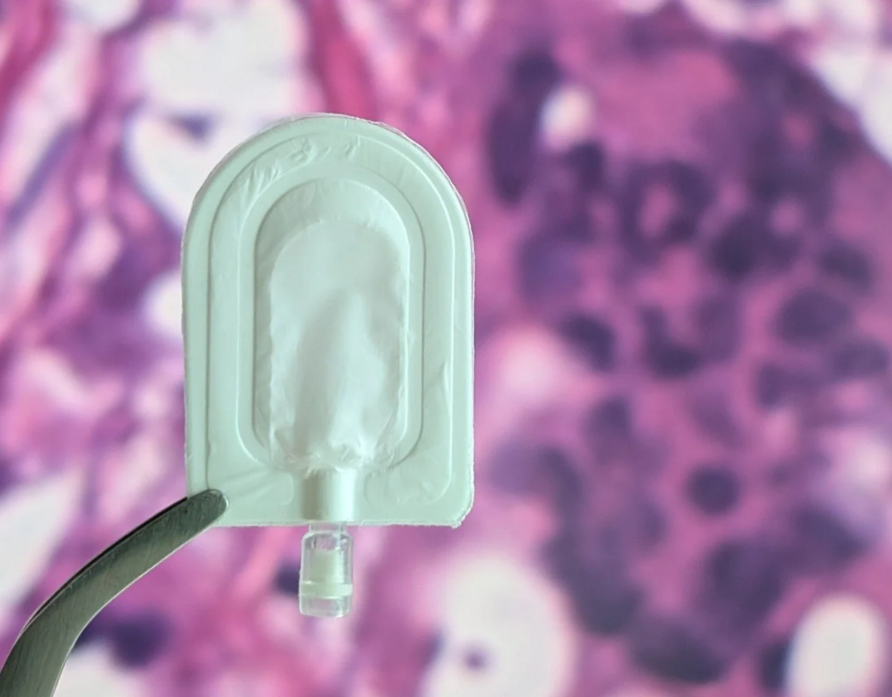 Cell therapy trial: Encellin’s device delivers promising early results