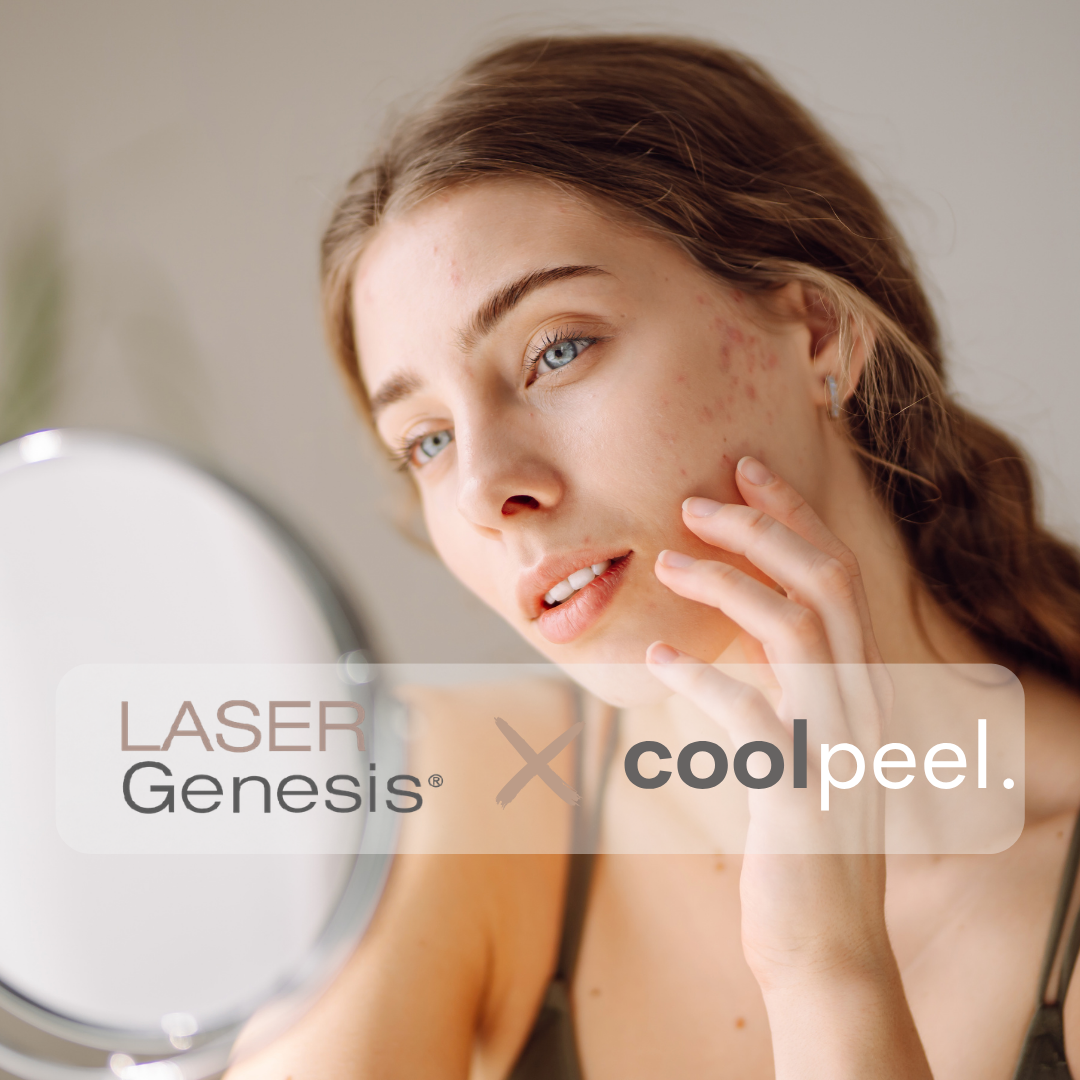 LG X Coolpeel.png