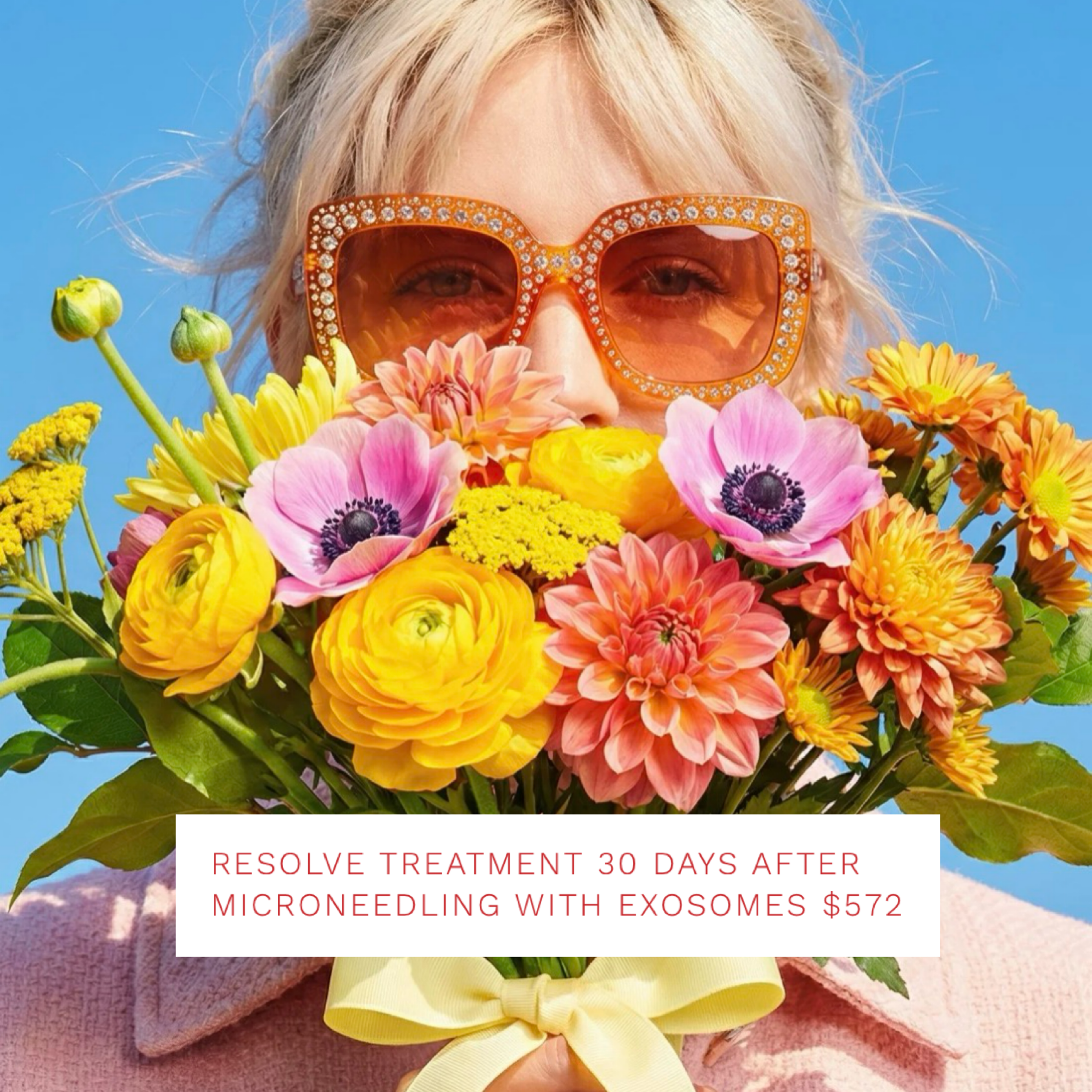 Resolve Treatment 30 days after 1 Microneedling with EXOSOMES
