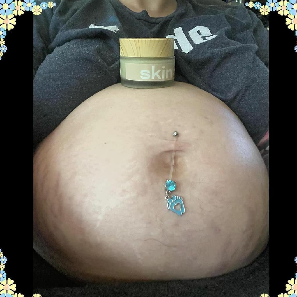 Have you tried n'ku on your stomach during pregnancy?
#stretchmarks #sheabutter #save20percent #nku #skingotyoucovered