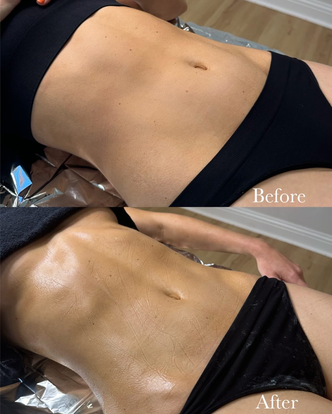 Ice sculpting Detox 🍃

Ready to learn how to provide results in 1 session ? 

.
.
.
.
.
.
.
.
.
.
.
.
.
 #feminineenergy #growth #manifestation #motivation #peronaldevelopment #bodysculptingdallas #bodysculptingonlineclass #bodysculptingsanjose #bod
