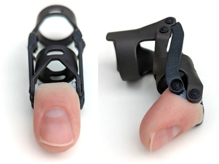Exo Prosthetics