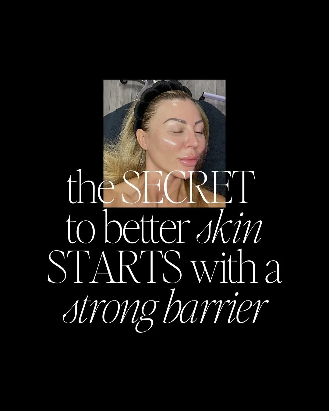 Your skincare isn&rsquo;t working? Your skin barrier may be compromised.‼️

Your skin barrier is more than just &ldquo;the surface.&rdquo; It&rsquo;s your built-in shield &mdash; locking moisture in, keeping irritants out, and maintaining that calm, 