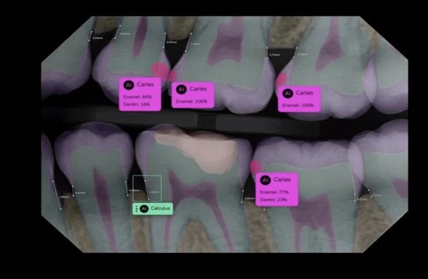 AI Technology, health optimisation, 2023 is happening at Paste Dental Belfast!