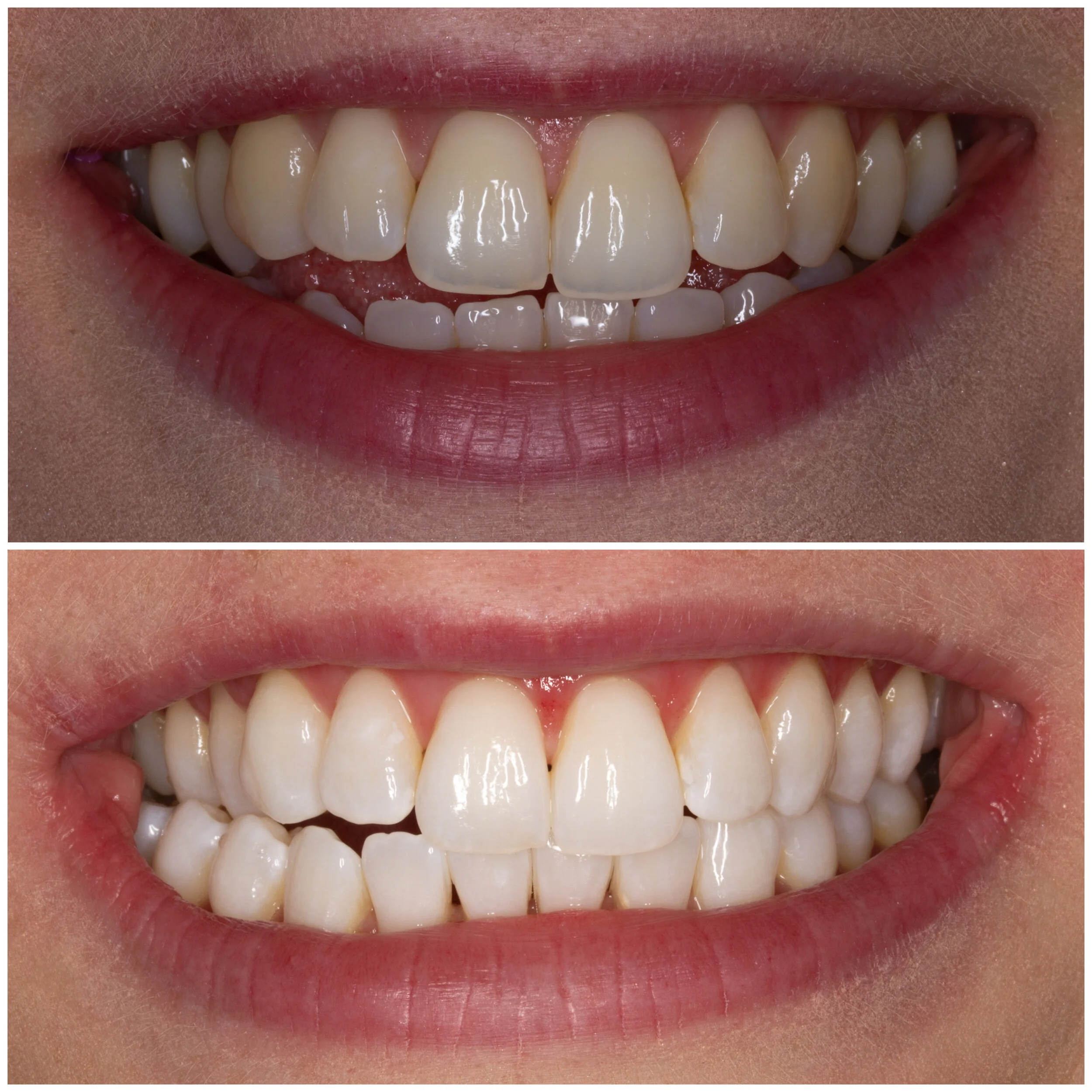 Enlighten Evolution Belfast Dental Studio — Paste Dental