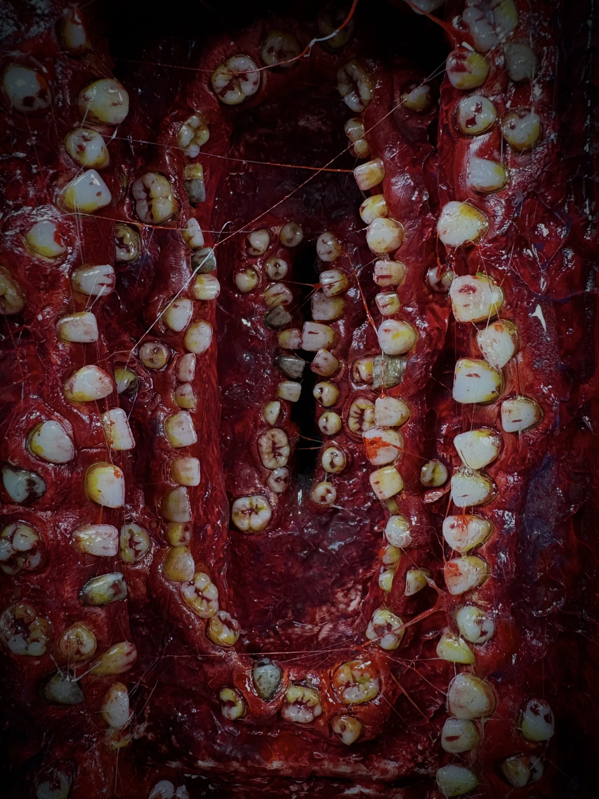 Close-up of an open human mouth showing teeth and gums with some teeth decayed and discolored.