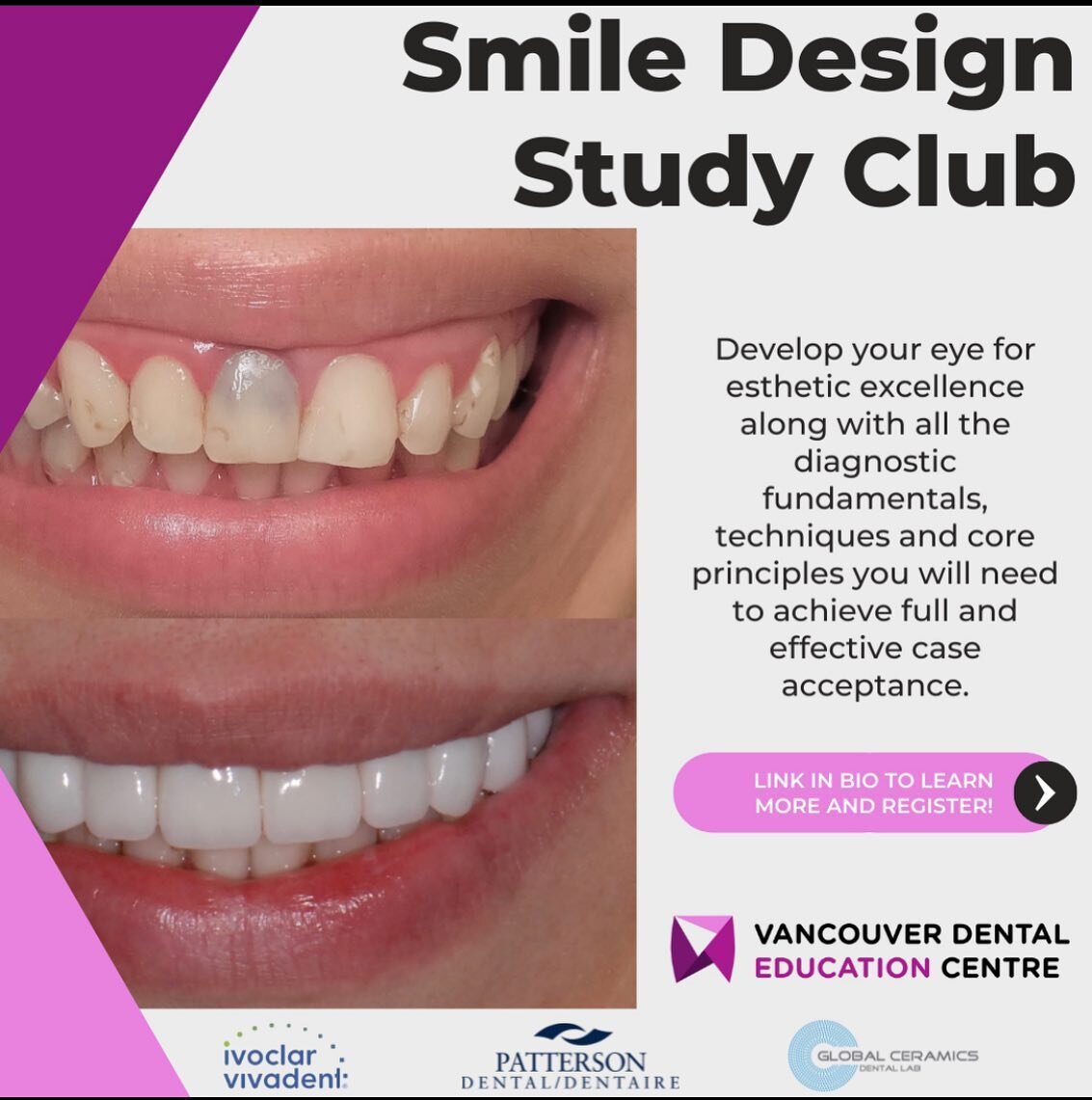 Smile design is back this spring! Visit @vdeceducation for more info!