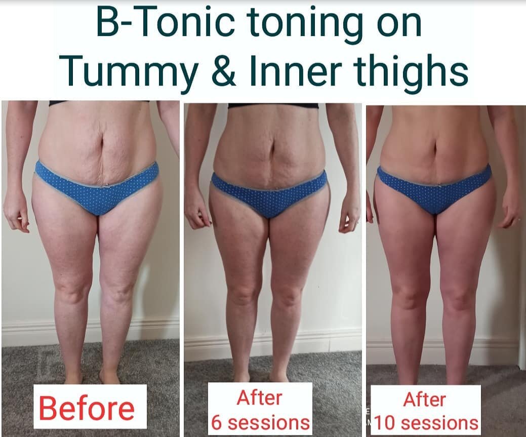 Transform your body in no time! 
Get these great results in just 3 to 5 weeks. B-Tonic body toning the only machine on the market that hits 36,000 crunches or squats in only 30 minutes. PM for more Info. #bodytoning #muscleup #slimmerbody #Carlow #bt