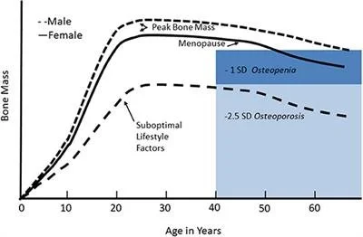 Bone Health &amp; Osteoporosis: What can you do about it &amp; what supports are available to you?