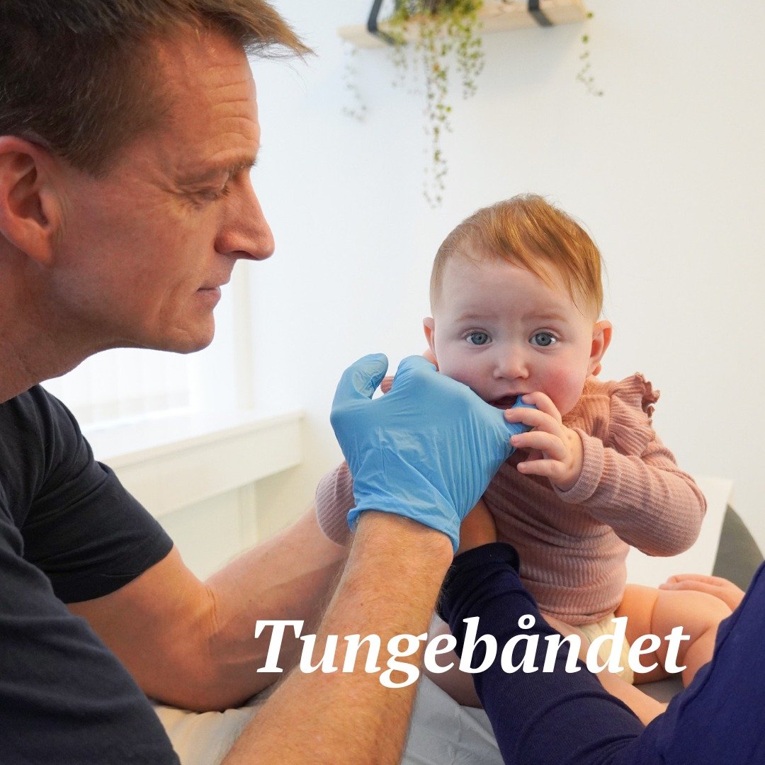 En meget omdiskuteret problematik hos sp&aelig;db&oslash;rn er tungeb&aring;ndet👅

I Danmark er vi generelt ikke s&aring; langt fremme i sundhedssektoren, n&aring;r det kommer til korrekt diagnosticering af for stramt tungeb&aring;nd, som de er i f.