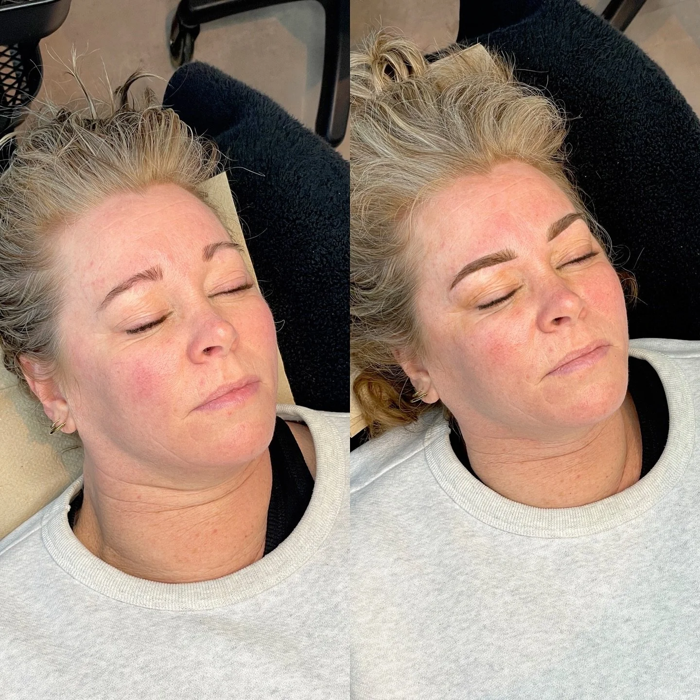 .
POWDER BROWS
&bull; Wake up with make-up
&bull; 2-3 jaar perfecte wenkbrauwen
&bull; Tijdsduur behandeling: 2 uur
&bull; Totaal 2 sessies
&bull; Nabehandeling na 5 weken 
&bull; Geschikt voor alle huidtypes
&bull; Hersteltijd: +/- 1 week

Word iede