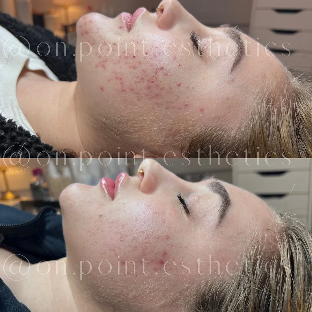 𝑻𝑬𝑨𝑴𝑾𝑶𝑹𝑲 𝑴𝑨𝑲𝑬𝑺 𝑻𝑯𝑬 𝑫𝑹𝑬𝑨𝑴 𝑾𝑶𝑹𝑲 ✨ 

.
.
.

This sweet babe came to me end of last year needing a change. After starting her health and wellness journey last year and introducing a lot of seemingly healthy products, such as; whe