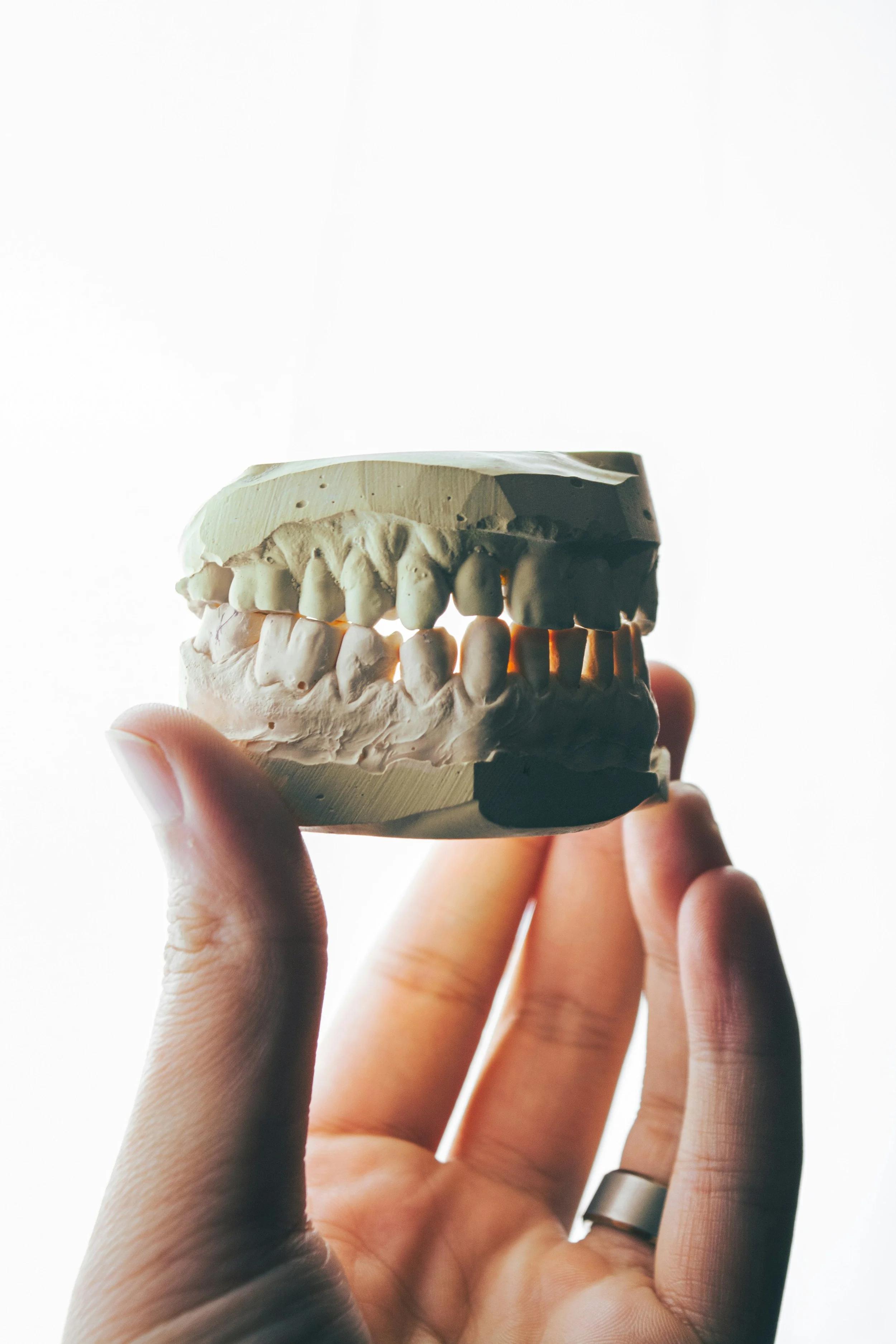 A hand holding a dental cast model showing upper and lower teeth against a bright background.