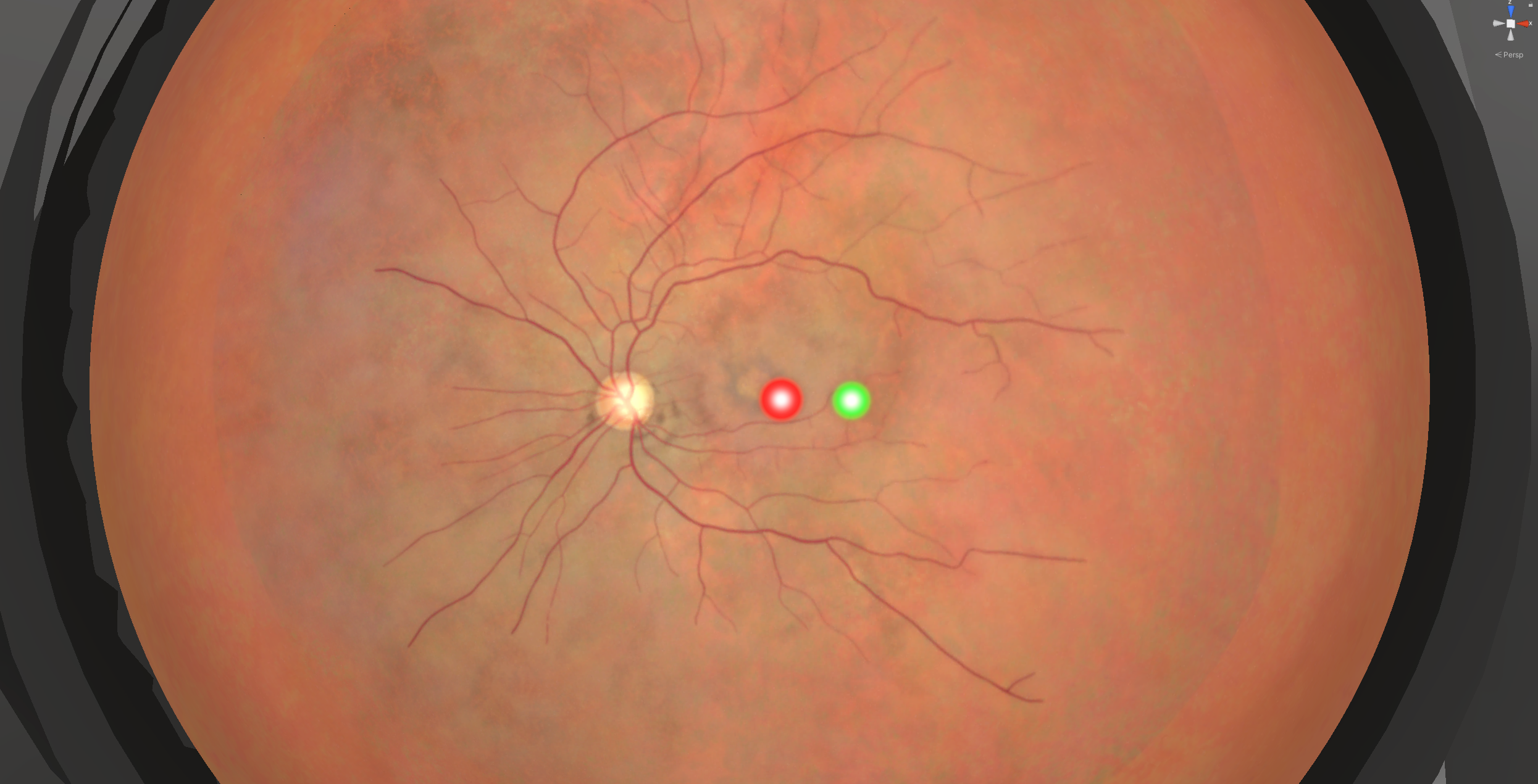 Laser photocoagulation