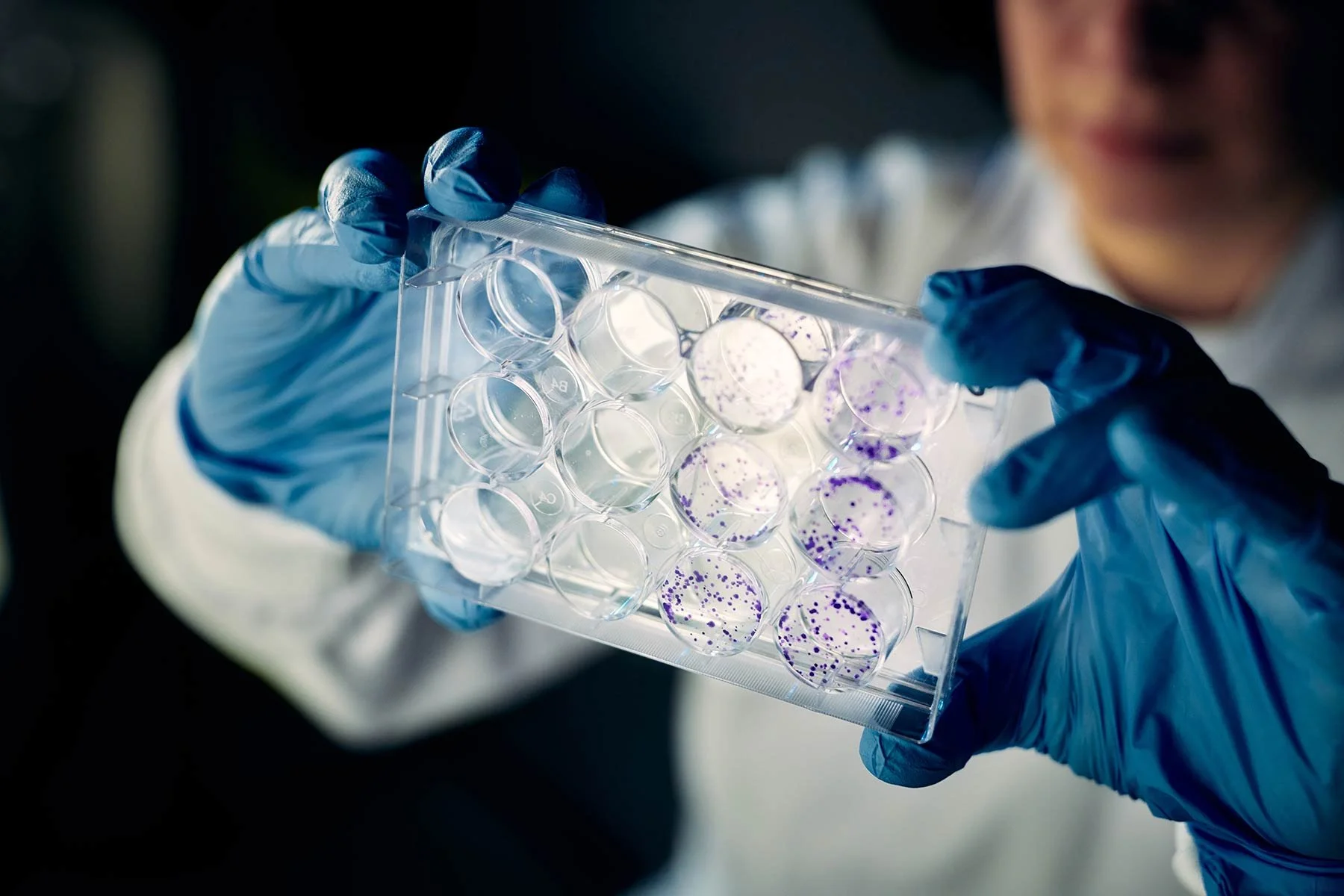 Cancer Research science photography