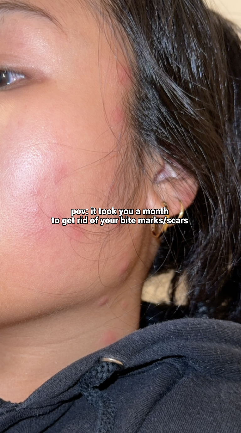 Related Video Item Thumbnail