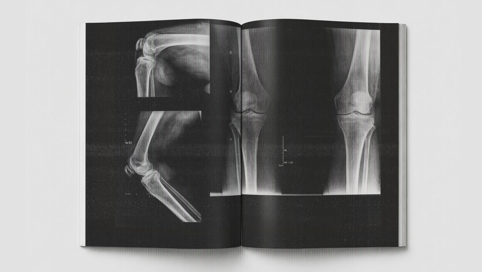 book_xray.png