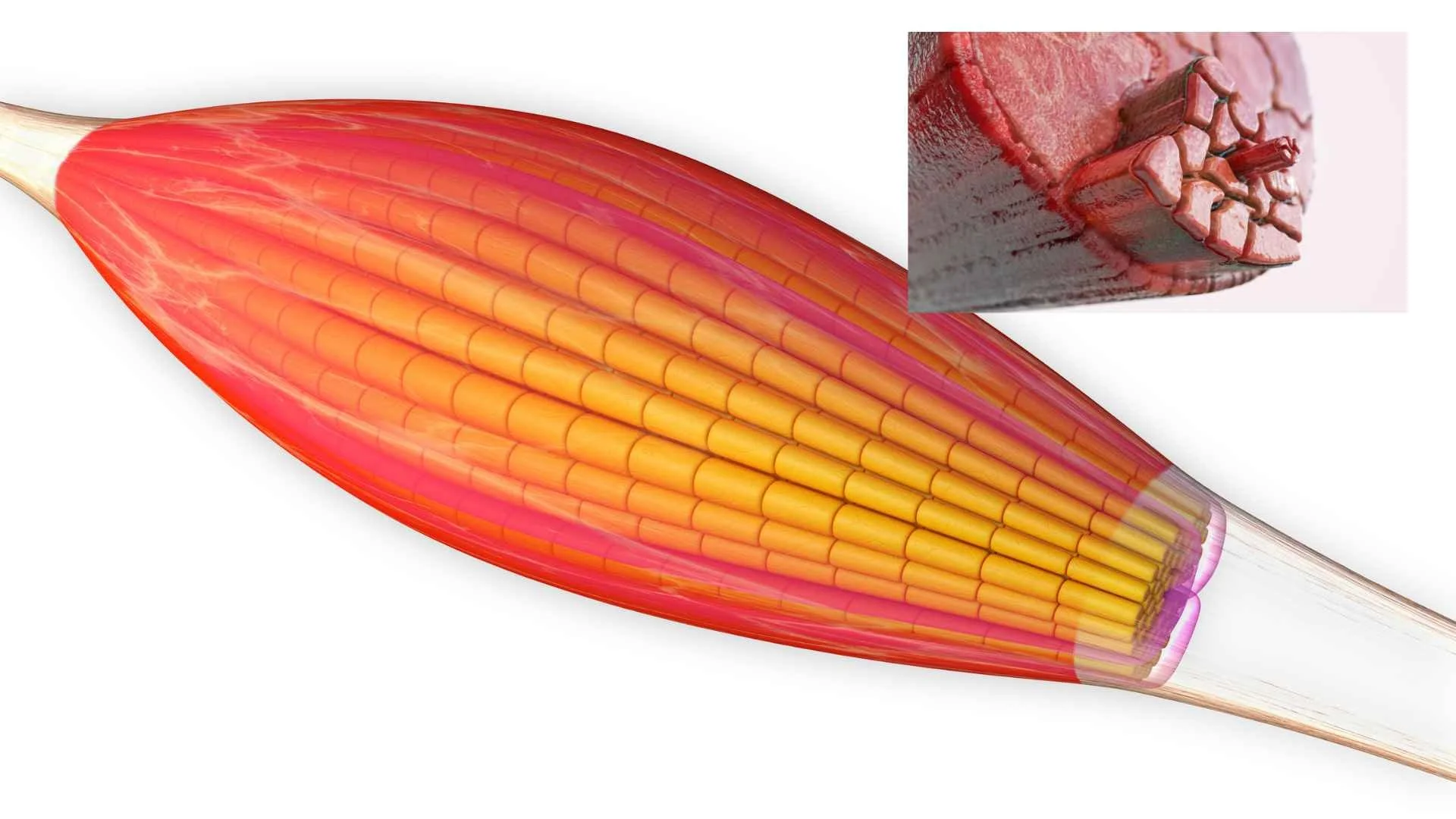 Why Happens To Your Type II Muscle Fibers with Age