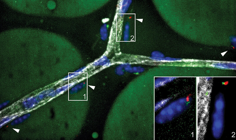 Fat pads expand by generating more fat cells and storing additional fat in existing fat cells. Balancing production of fat cells with lipid accumulation is critical for “healthy” fat. This micrograph shows a mouse gonadal fat pad with mature fat cell