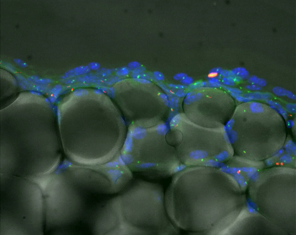 Ciliated preadipocytes are sited on blood vessels in fat pads. DNA is blue, vasculature is white, lipid droplets in mature fat cells is green, centrosome is green, and ciliary axoneme is red. Murine white adipose tissue. Adapted from Hilgendorf et al