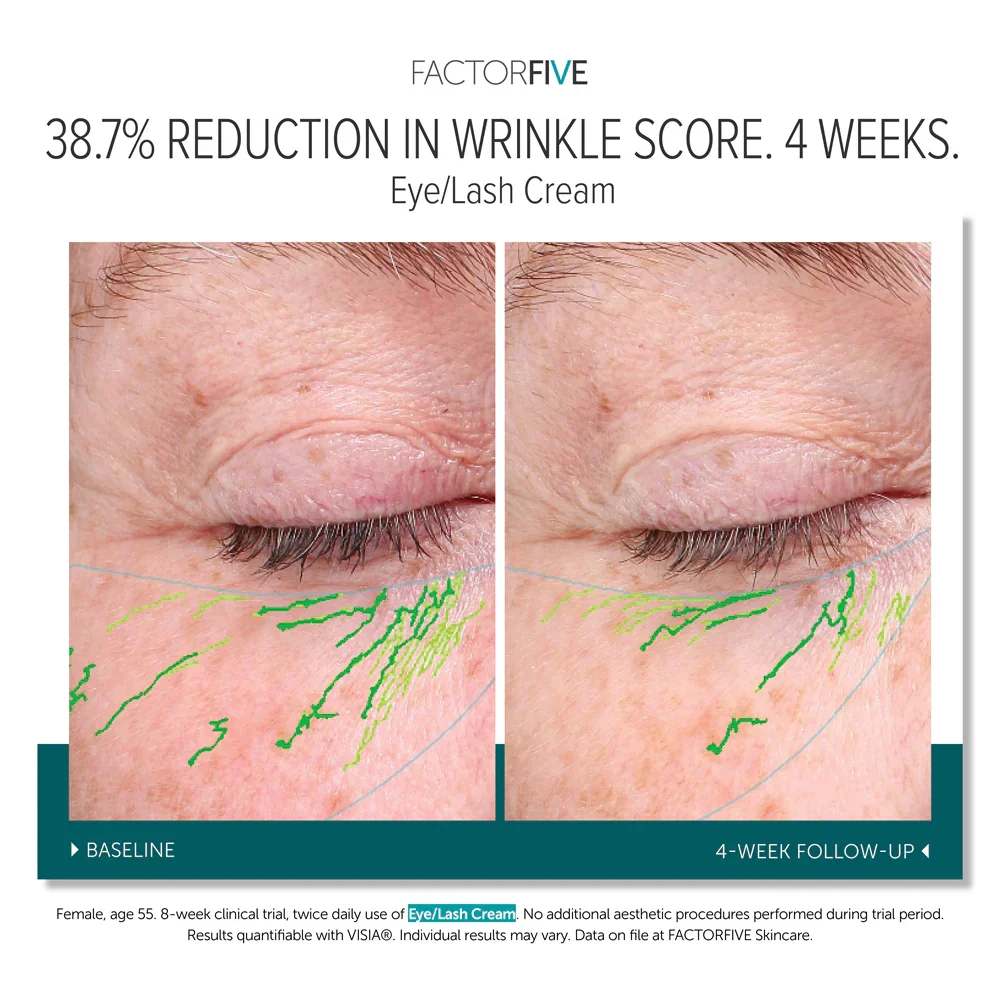 eye cream.webp