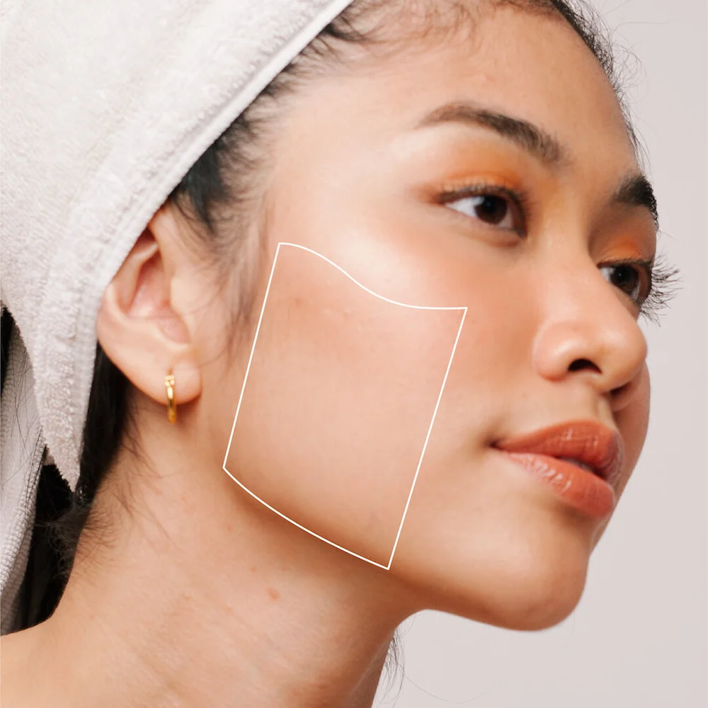 Ultherapy Prices & Personalization — Simply Skin