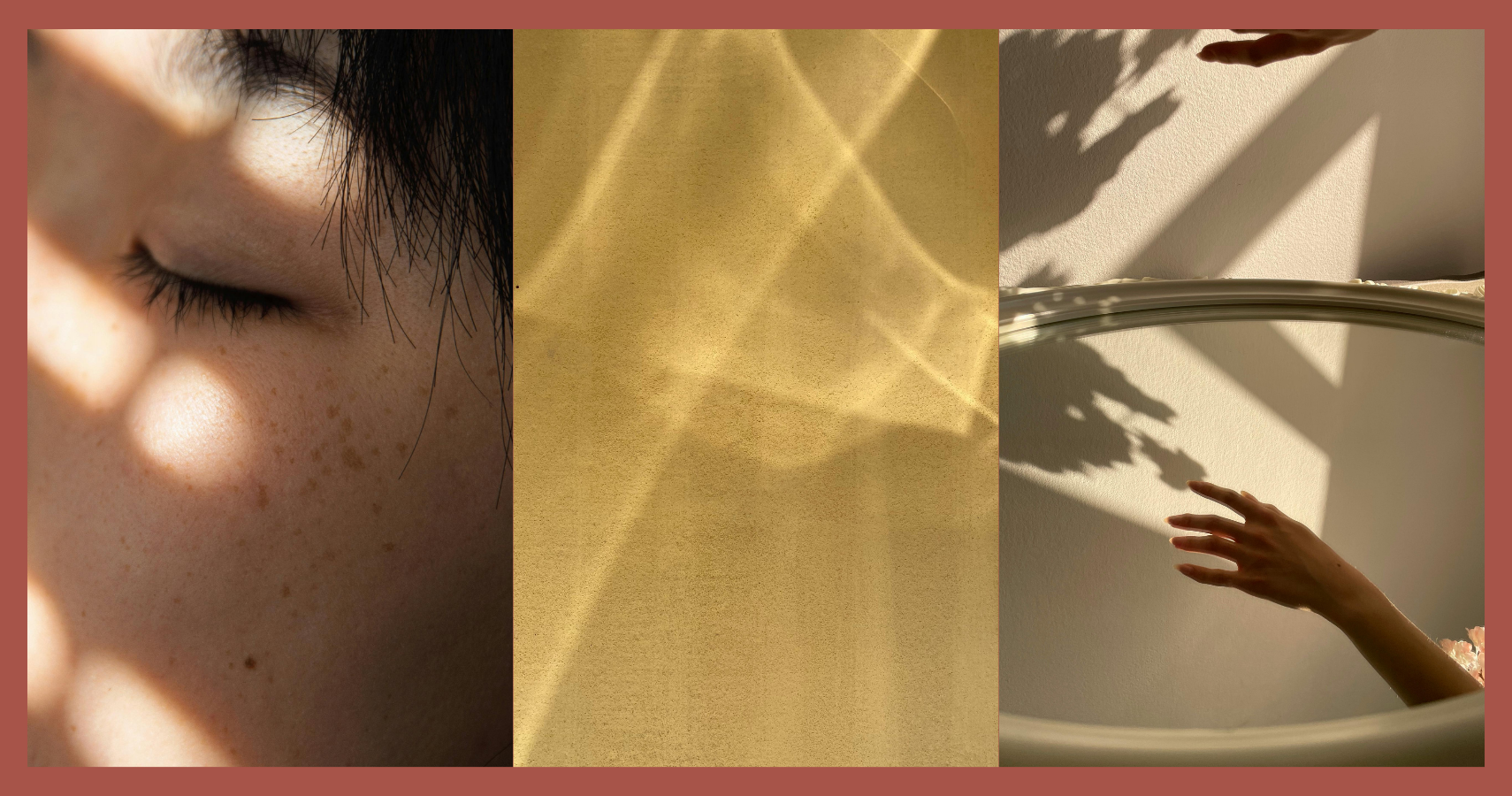 The Gentle Approach to Melasma: Less Irritation, Better Results
