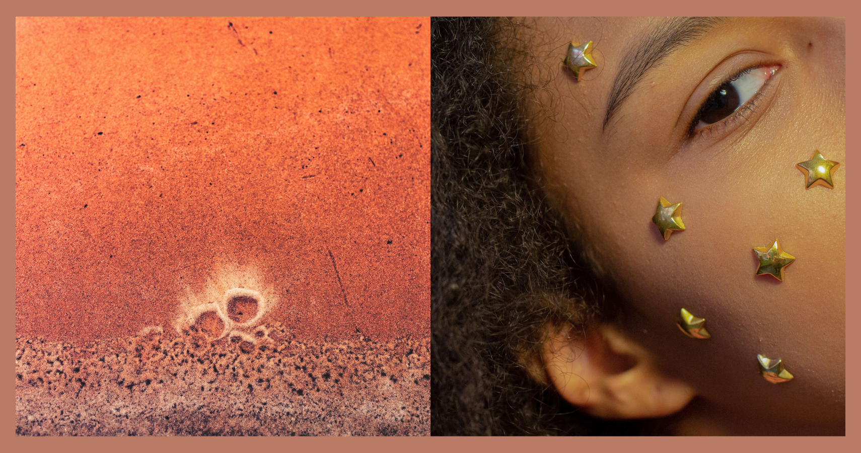 What It Really Takes to Improve Pitted Acne Scars
