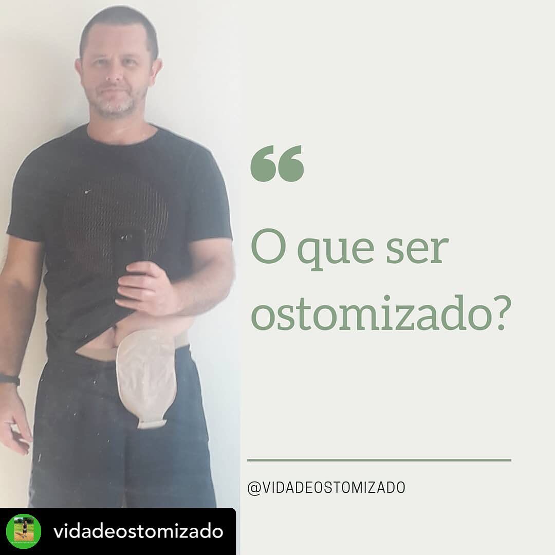 RePosted @withregram 
&bull; @vidadeostomizado 

📌 Ser ostomizado&nbsp;não é apenas ser alguém que tem um estoma na parede abdominal...

📌 Ser ostomizado não é apenas viver com uma bolsa para coleta de fezes ou urina presa ao abdômen...

📌 S