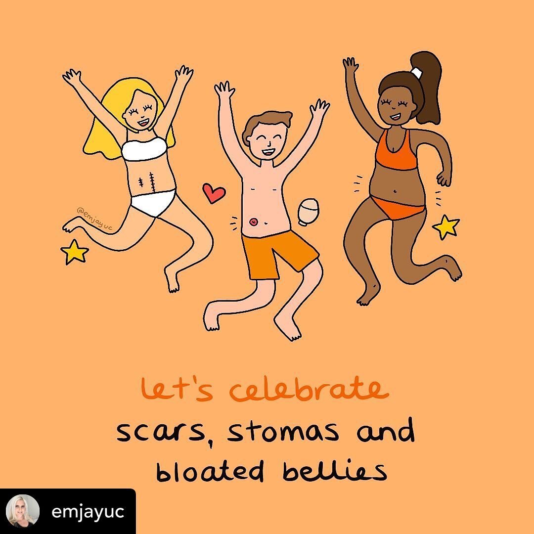 RePosted @withregram 
&bull; @emjayuc Let&rsquo;s celebrate 💜
⠀⠀⠀⠀⠀⠀⠀⠀⠀
Let&rsquo;s celebrate ostomates, IBD, IBS, endo and other chronic illness warriors! Your scars, stoma(s) or bloated bellies are symbols of strength, resilience and courage. Thes