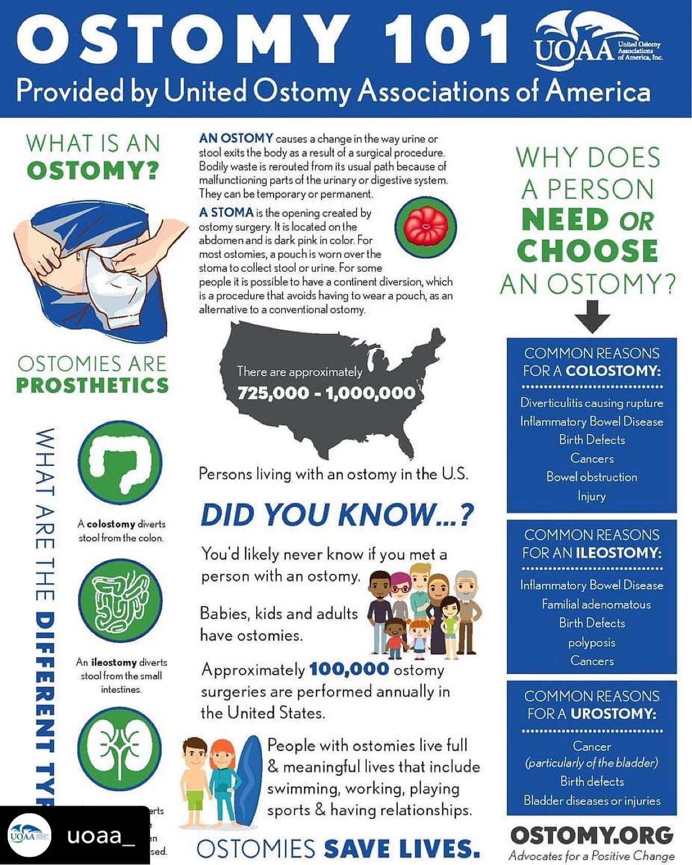 RePosted @withregram 
&bull; @uoaa_ 
&bull; An easy way to share some ostomy facts this #OstomyDayUSA to raise much needed #ostomyawareness 
USA Ostomy Facts 
&bull;
&bull;

Best,
 IOA 20/40 Focus Group
.
.
.
.
.
.

.
.
.
.
.
#ostomia #ostomias #osto