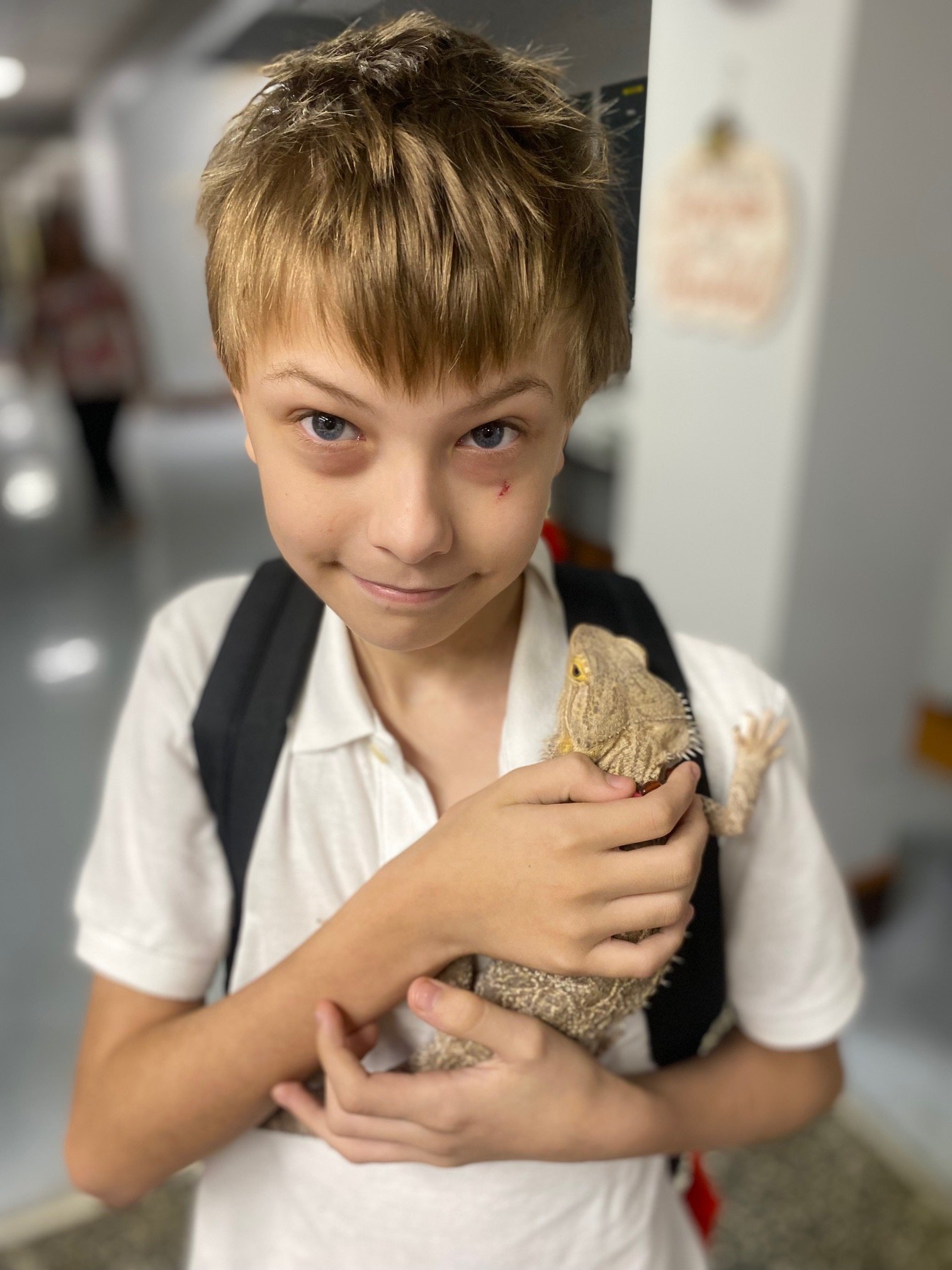 A young boy with light brown hair and blue eyes is holding a sleeping bearded dragon lizard close to his chest. The lizard's body is partially covered by the boy's arms, and the boy has a small scratch or injury near his left eye.