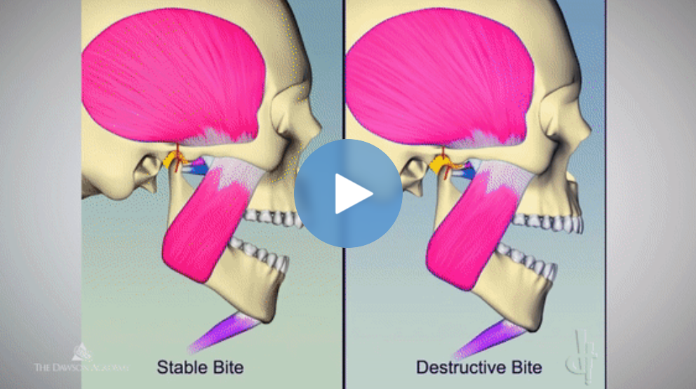 Functional Occlusion An Introduction to Problem Solving — Masters