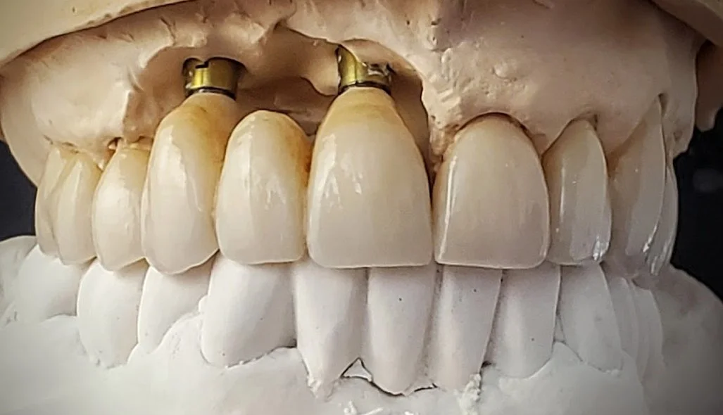 Dental Lab Halifax Dental Laboratory Masters Dental