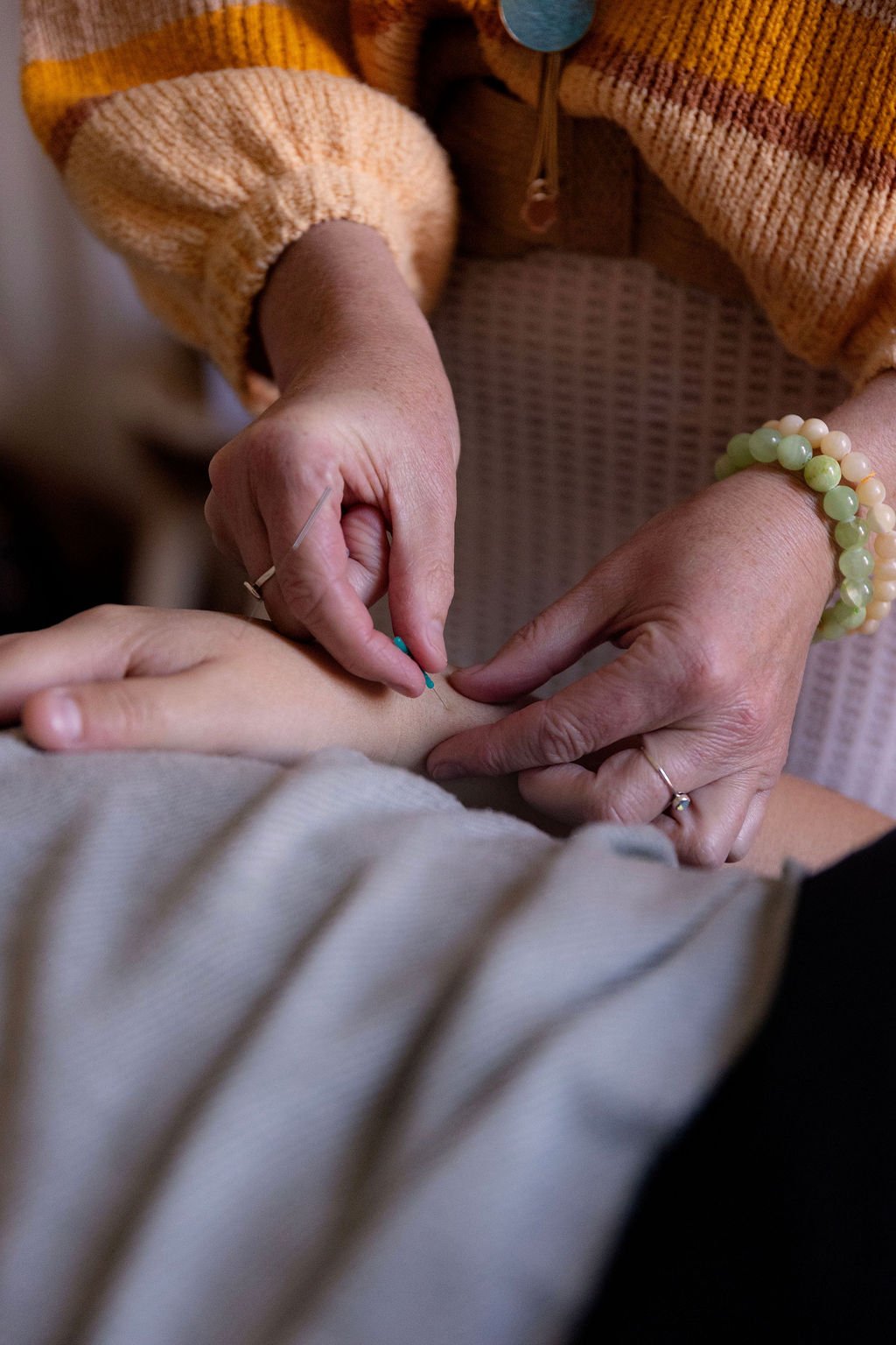 Acupuncture in McLaren Vale