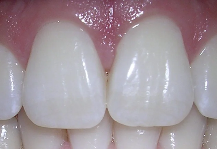 Mit Biss an die Schlichtungsverhandlung