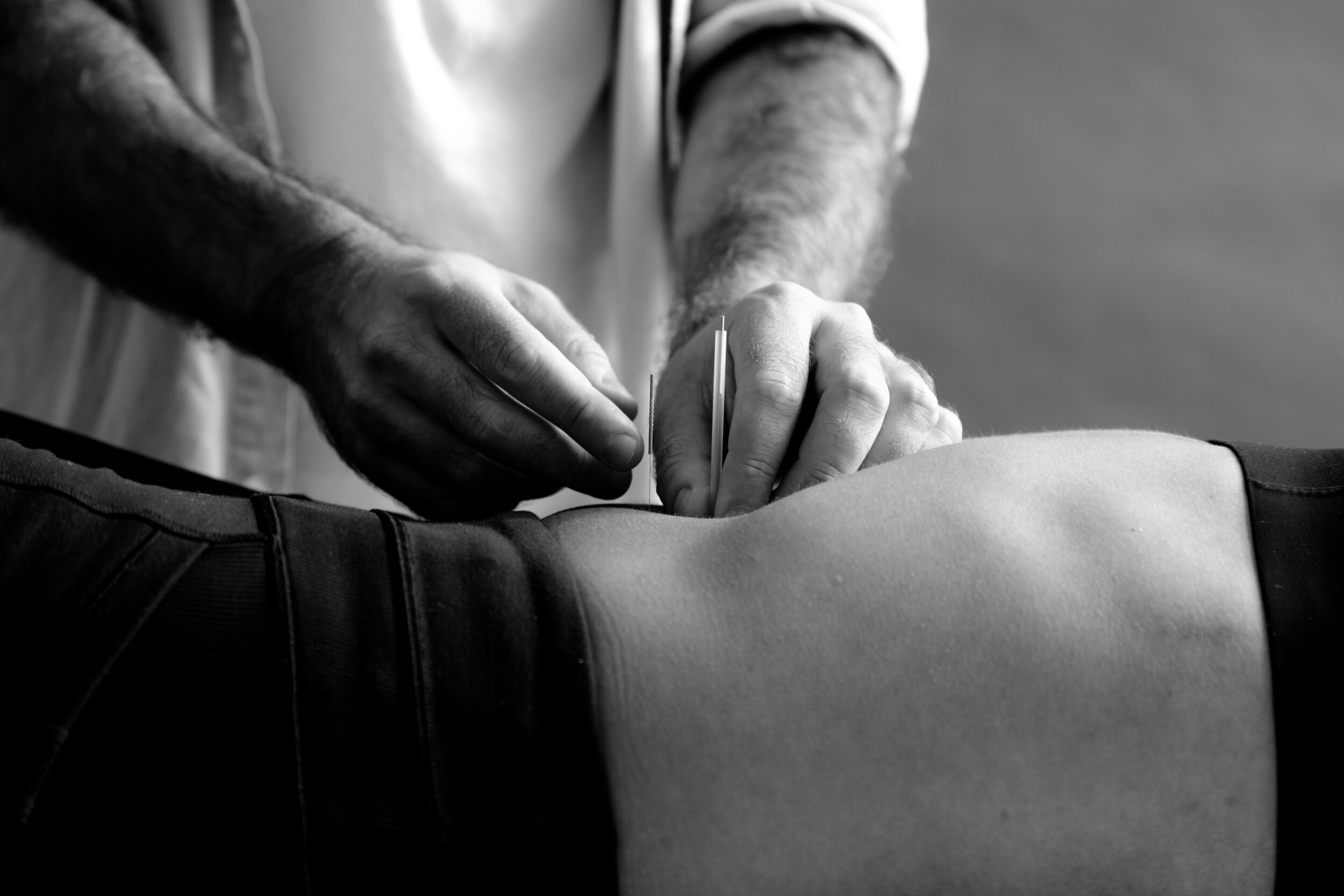 CarlyGaebe_MichaelKabram_Acupuncture-22.jpg