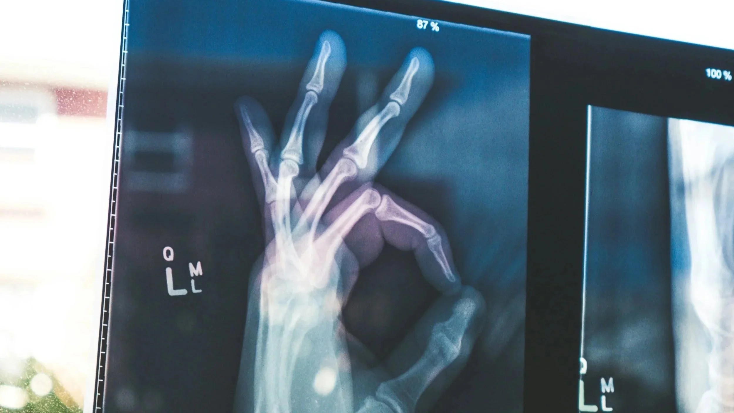 L’IA médicale à l’épreuve du réel