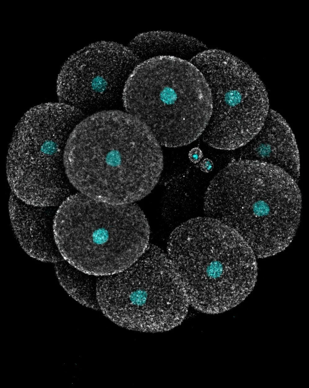 Local and global changes in cell density induce reorganisation of 3D packing in a proliferating epithelium