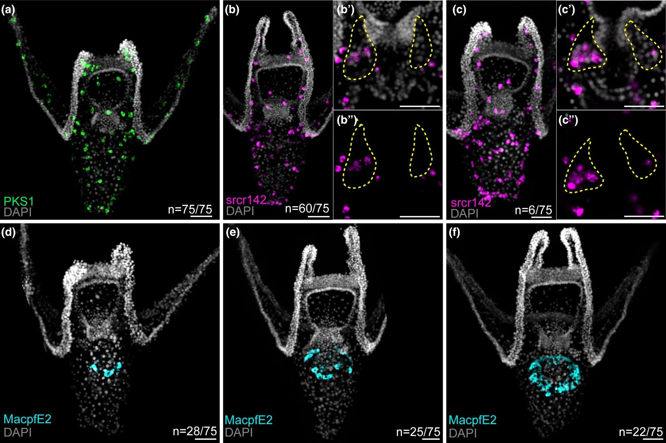 Characterization of cellular and molecular immune components of the painted white sea urchin Lytechinus pictus in response to bacterial infection