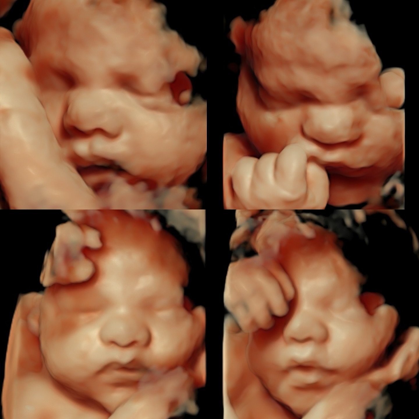 Sentiments now offers a waitlist! Simply go on my booking site and select your desired exam. When you get to the date selection section, if you don&rsquo;t see an opening on your desired date, click &ldquo;join the waitlist&rdquo;. You can then selec