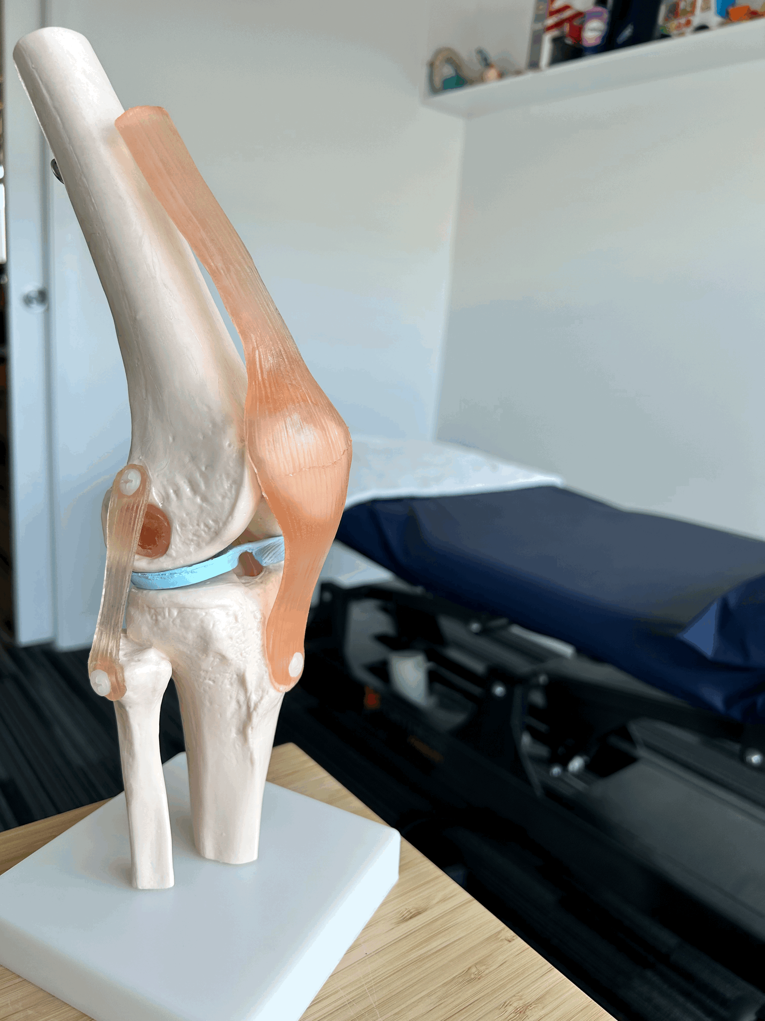 Osteochondritis Dissecans
