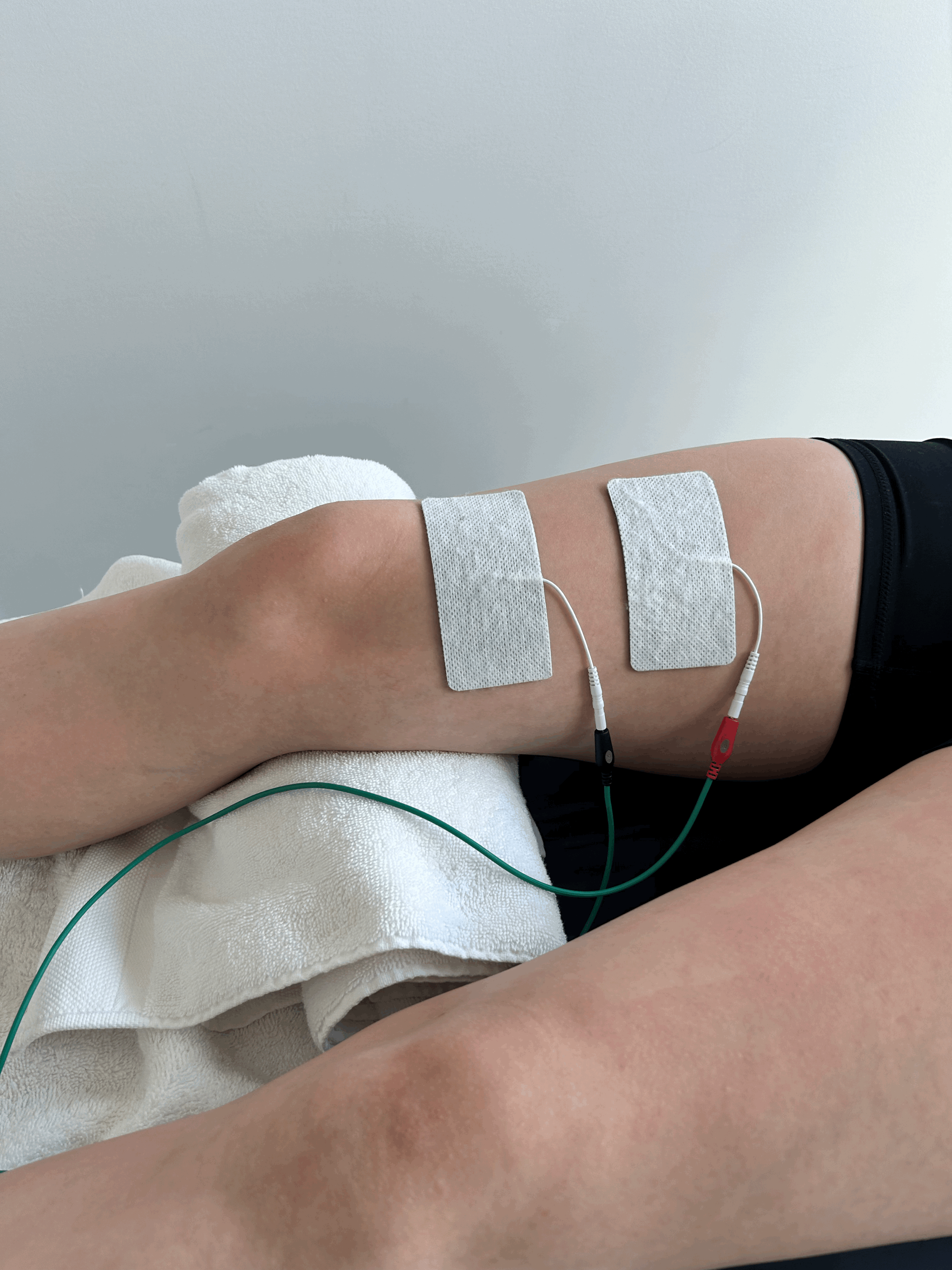 Patellofemoral pain syndrome (PFPS)