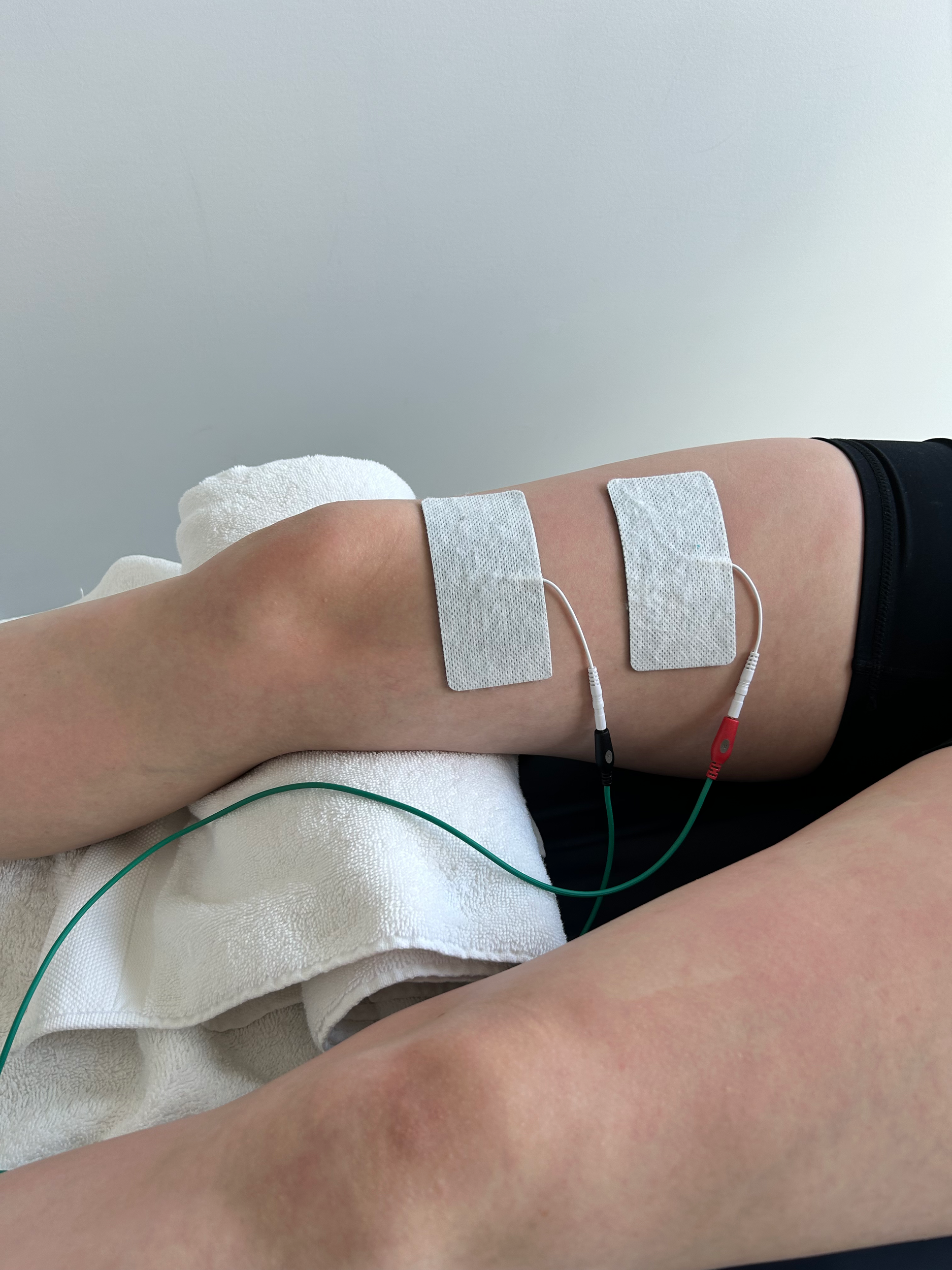 Transcutaneous electrical stimulation of VMO