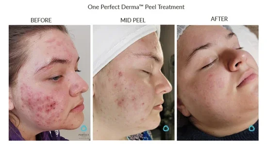 Before_After-Website-36_550x.webp
