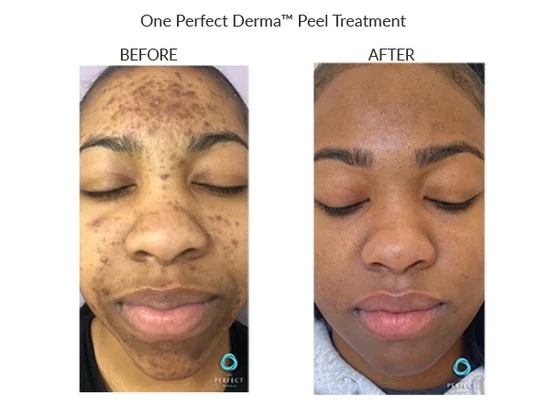 Before_After-Website-33_dc7df7fb-5f3a-44de-b1df-649ef66d3c8e_550x (1).webp