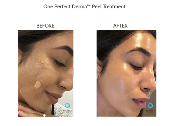 Before_After-Website-39_1_550x.webp